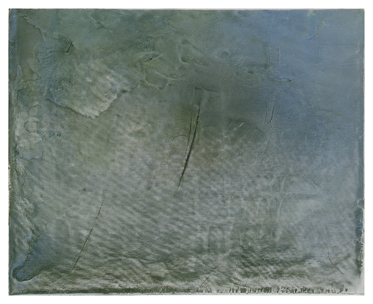 Des bleus (5)