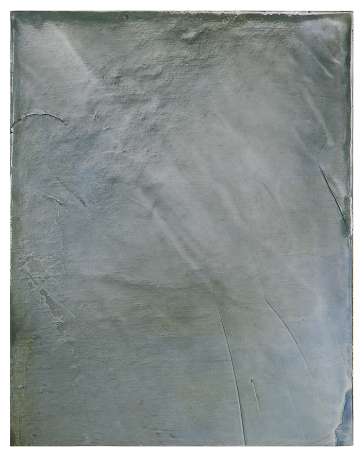 Des bleus (4)